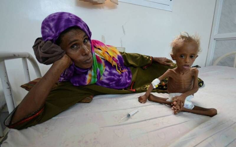 Yemen-hunger