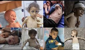 GazaHunger