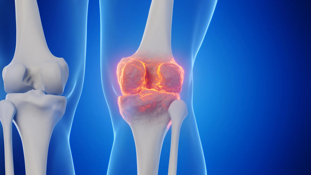 Knee Joint